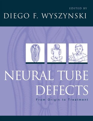 Neural Tube Defects: From Origin to Treatment