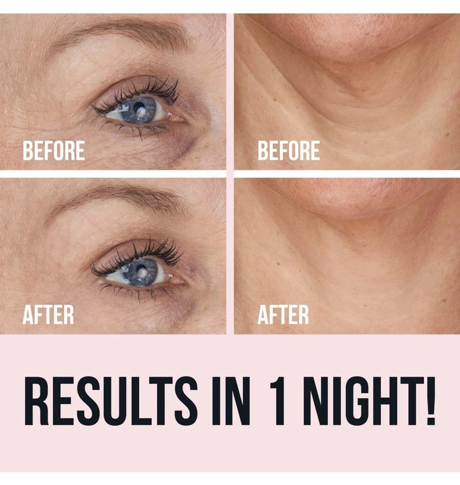 Sio Beauty Anti Aging Skin Treatment Patches For Neck Forehead And Smile Lines - Image 2 of 4