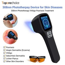 308nm UVB Light Therapy Device for Effective Skin Treatment and Healing Solution