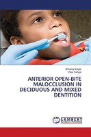 Shivangi Dagar (U. A.) | Anterior OPEN-BITE Malocclusion IN Deciduous And...