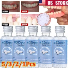 5/3x Tooth Repair Beads Granules,Temporary Moldable Dental Pellets, False Teeth