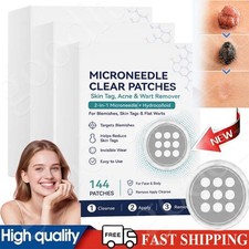 Curalona Microneedle Patches 144pcs, Skin Tag Wart Acne Remover Patches 20 OFF