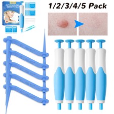 Auto Micro Skin Tag Remover 40x Rubber Bands 10x Alcohol Pads Mole Wart Removal