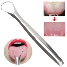 4Pcs Stainless Steel Tongue Scraper for Oral Health and Fresh Breath
