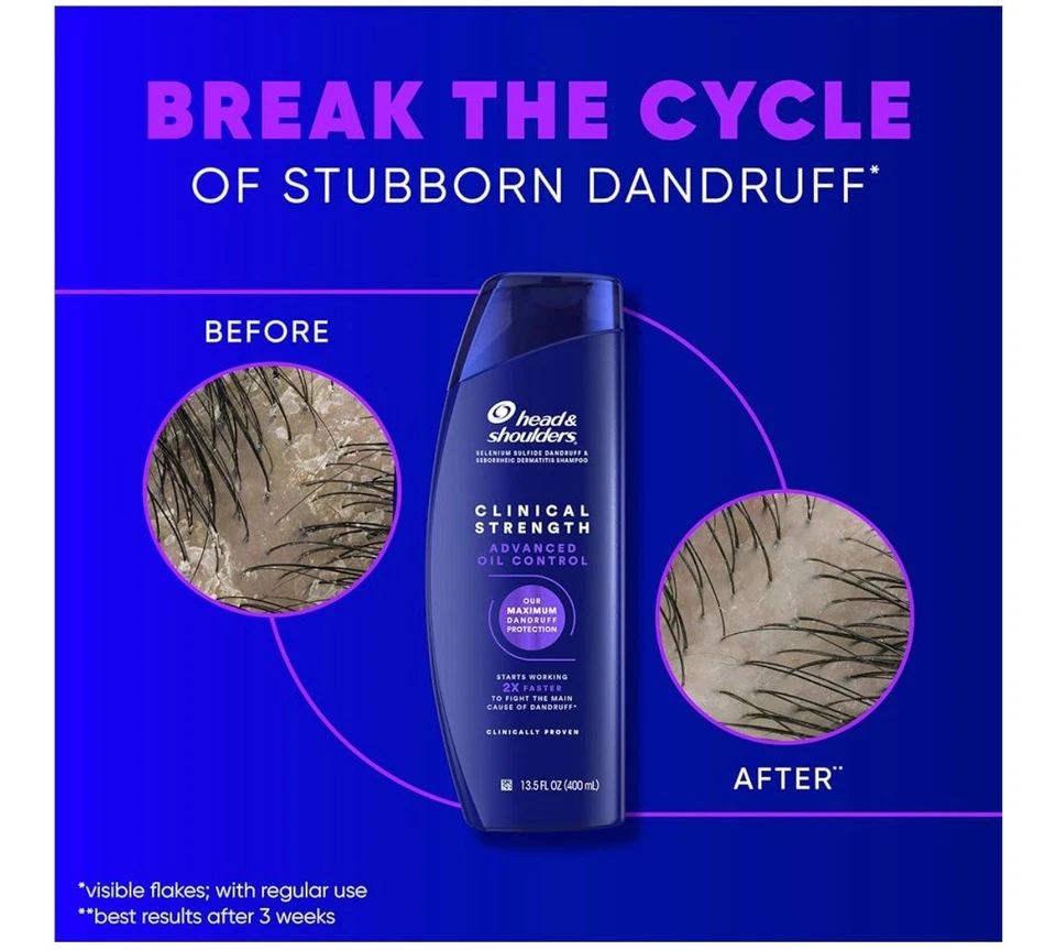 Head & Shoulders Clinical Strength Dandruff Shampoo 13.5 Oz Each. 2 PACK - Image 4 of 4