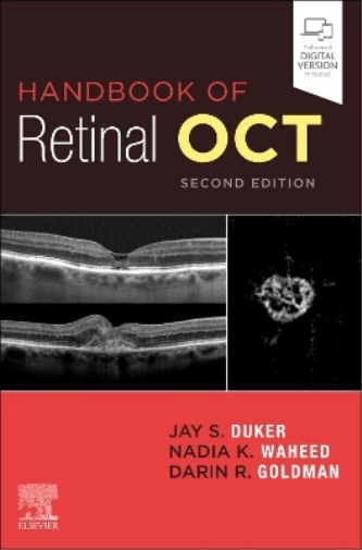Jay S. Duker Darin Goldman N Handbook of Retinal OCT: Optical Cohere (Tascabile)