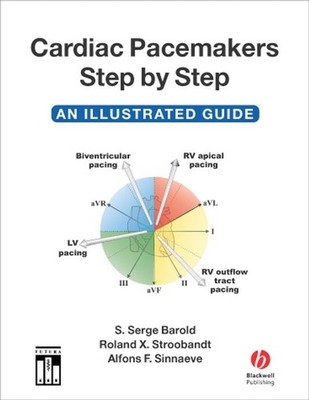 Cardiac Pacemakers Step-by-Step: An Illustrated Guide
