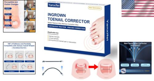 Ingrown Toenail Relief Kit with Memory Wire Corrector Strips - 8 Strips Included - Picture 2 of 8