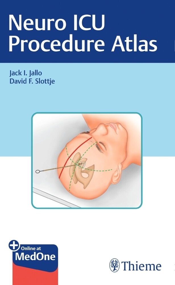 Thumbnail - Neuro Icu Procedure Atlas | Jack I. Jallo (u. A.) | Including Online