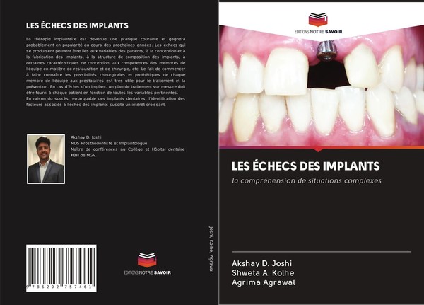 Akshay D. Joshi (U. A.) | LES ÉChecs DES Implants | Taschenbuch | FranzöSisch-image