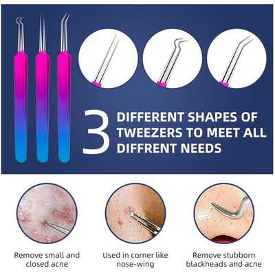 Blackhead Remover Kit - 10 Pcs, Stainless Steel