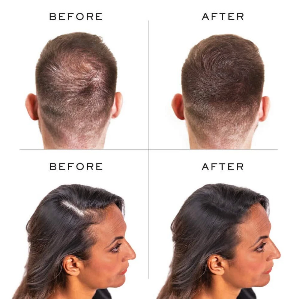 Fibras capilares nanogénicas para adelgazamiento del cabello volumen instantáneo 1,05 onzas 100 K naturales... Foto 4 de 4