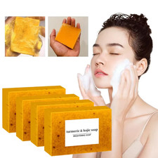 Turmeric Kojic Acid Brightening Soap Skin Whitening Dark Spot lightening Acne UK
