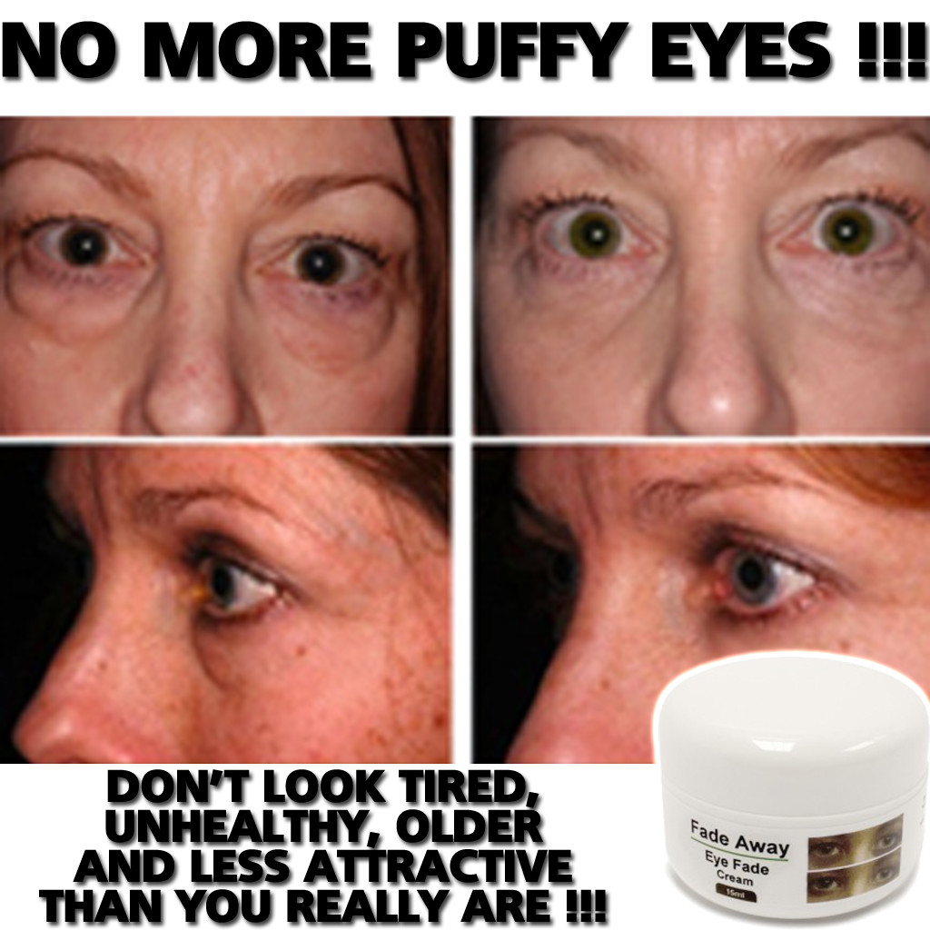 hemorrhoid-cream-for-puffy-eyes