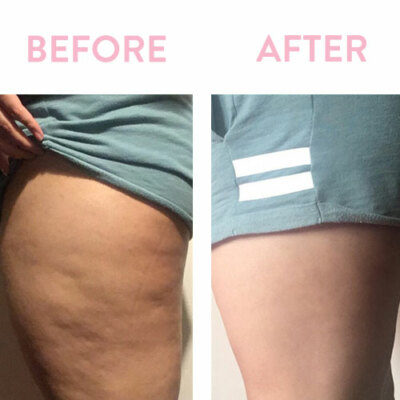 Anti Cellulite Massage Oil-Tones Skin & Helps Shrinks Stretchmarks By Chakra