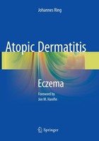 Atopic Dermatitis Johannes Ring