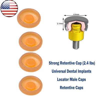 US Overdenture Locator Abutment 2.4 lbs Removable Retentive Male Caps 4pcs