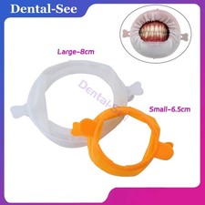 Retrattore Guance Dentali Forma O Gomma Diga 3D Labbra Denti Sbiancamento Apri Bocca