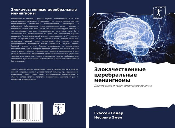 Zlokachestwennye Cerebral'nye Meningiomy Ghassen Gader-image