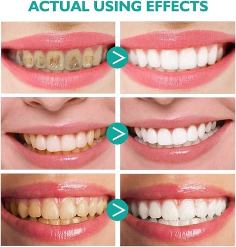 2 PCS Teethaid Mouthwash Whitening Toothpaste Foam Refreshing Breath - Picture 2 of 8