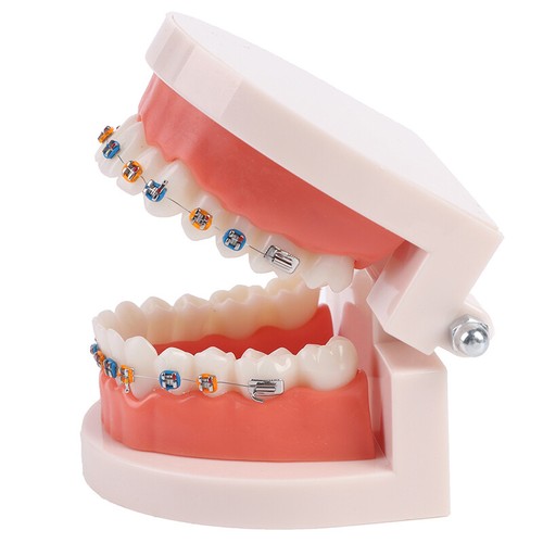 Dental Orthodontic Teeth Model With Metal Braces School Teaching Equipme.ac