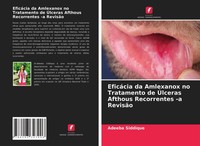 Adeeba Siddique | EficáCia Da Amlexanox No Tratamento De ÚLceras Afthous...
