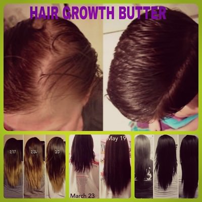 Longer Hair Fast Growing Enhancing Stronger Bald Edges Solved Hair