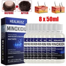 8X Minoxidil 5% Extra Strength for Men Hair Regrowth Treatment Topical Solution