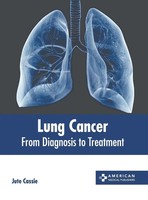 Jute Cassie | Lung Cancer | Buch | Englisch (2023) | From Diagnosis To Treatment