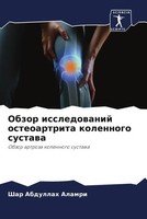 Obzor Issledowanij Osteoartrita Kolennogo Sustawa Shar Abdullah Alamri Buch 2022