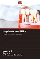 Lavanya S (U. A.) | Implants En Peek | Taschenbuch | FranzöSisch (2023)