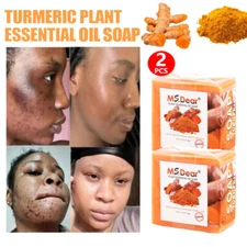 2PCS Tumeric Soap For Dark Spots, Skin Lightening, Anti Acne Cleansing Soap Bar