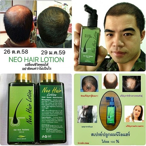 4 pcs. Neo Hair Lotion Hair Care Leave On Treatment Green Wealth Growth 120 ml. | eBay 4 pcs. Neo Hair Lotion Hair Care Leave On Treatment Green Wealth Growth 120 ml. | eBay