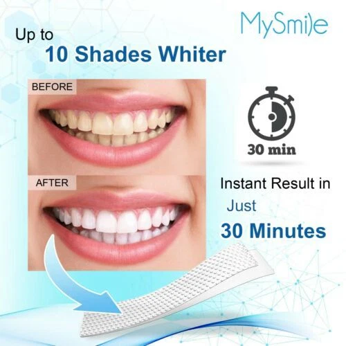 MySmile 28pc 6%HP Teeth Whitening Strips Non Sensitive White Strips