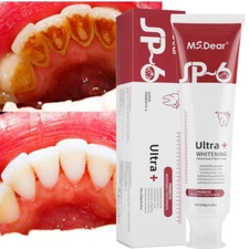 2025 SP-6 Probiotic Toothpaste,Sp-6 Toothpaste Whitening Quick White Toothpaste