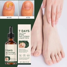 Tea Tree Ginger Nail Fungus Care Liquid 30ml Nourishing Antibacterial Repair US