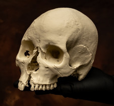 Human Skull Replica | Life Size | Medieval Warrior sword Wound  Anatomical Model