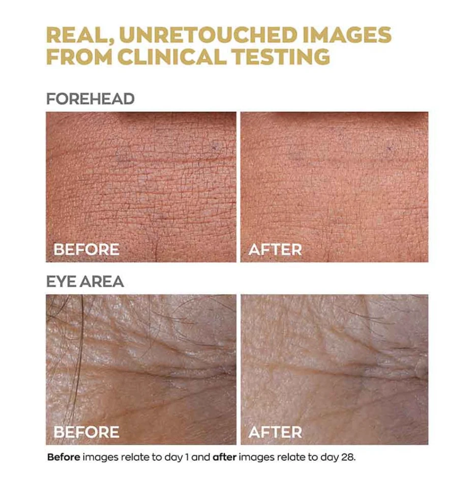 Suero Avon Anew Renewal Power con Protinol 1,0 fl oz - 30 ml Foto 4 de 4