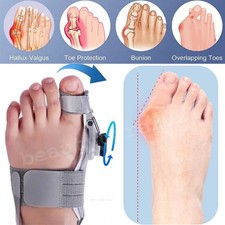 NHS Adjustable Hallux Valgus