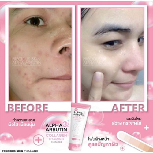 ALPHA ARBUTIN 3+ COLLAGEN FOAMING Cleanser For All Skin Type 120ml - Picture 3 of 8