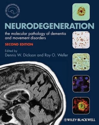 Neurodegeneration: The Molecular Pathology of Dementia and Movement Disorders by
