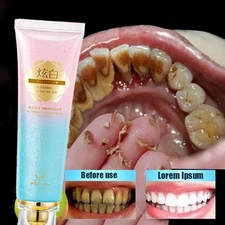 Niacinamide Whitening Toothpaste,Natural Niacinamide Toothpaste,Teeth Whitening