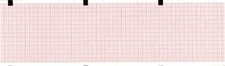 ECG Paper 80MM X 90MM X 360Sheet Works for HELLIGE CONTRAST, and Others PK 5