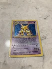 Pokemon TCG Alakazam 001/102 Base Set (Shadowless) -1st Edition Holo