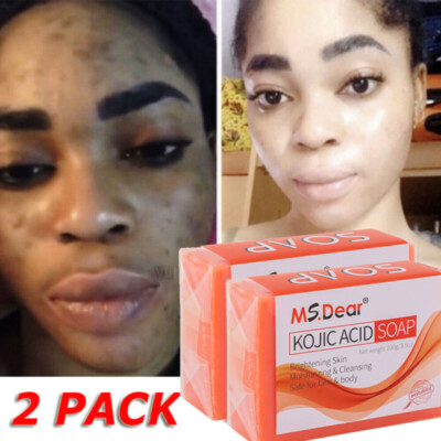 2Pcs Kojic Acid Soap Acne Dark Spot Remover Skin Lightening Whitening Face Body