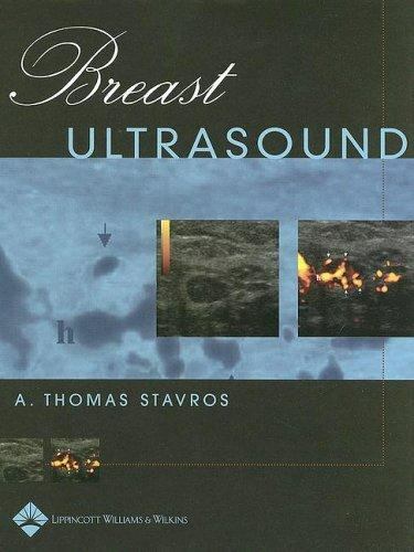 健康・医学 Breast Ultrasound A. Thomas Stavros Breast Ultrasound: 9780397516247: Medicine & Health Science