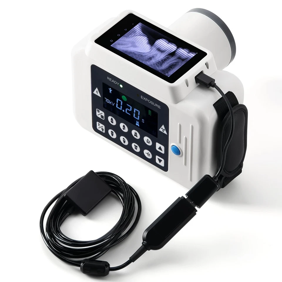 Máquina digital de rayos X portátil dental de alta frecuencia/escudo/sensor Foto 3 de 4