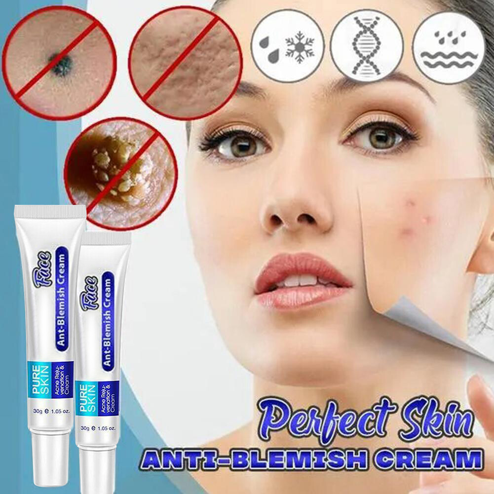 best face cream for blemishes