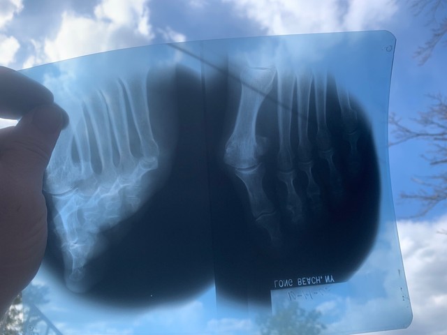 5 POUNDS scrap Exposed xray film silver recovery 1990s