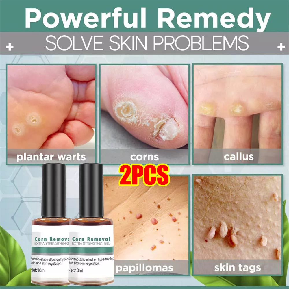 Corn Remover for Feet, Removes Callus, Toe Corns  